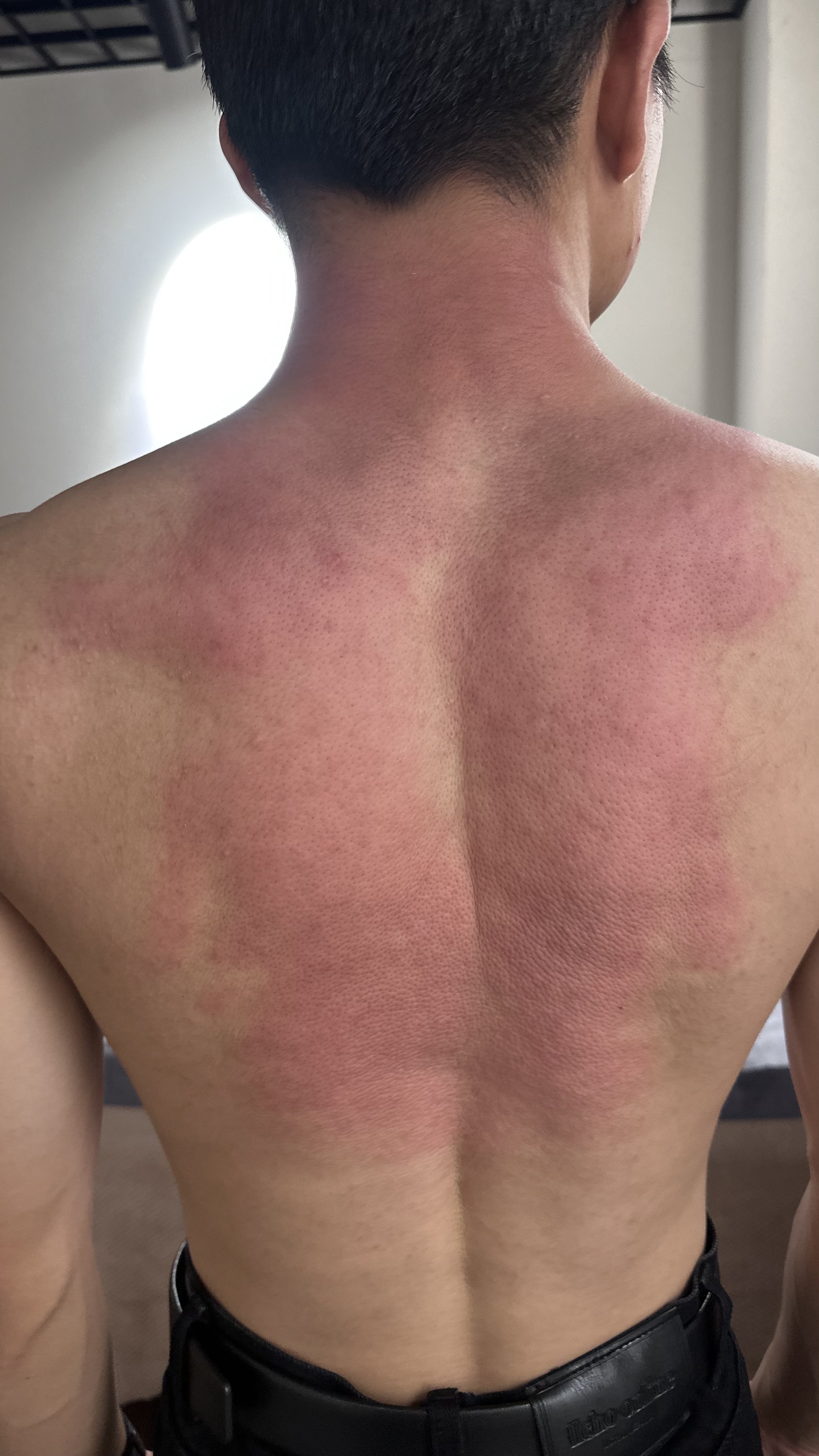 小细狗